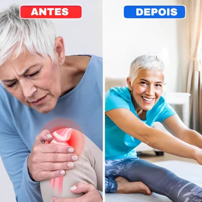 Imagem de Antes e depois com uso do Flexlive